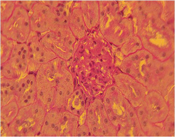 ОТСУТСТВИЕ ПАТОЛОГИЧЕСКИХ ИЗМЕНЕНИЙ  ВНУТРЕННИХ ОРГАНОВ КРЫСЫ ПРИ ВВЕДЕНИИ АЛЛОГЕННОГО ГАП